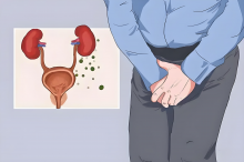 前列腺炎反复难愈？4个日常护理方法帮你缓解