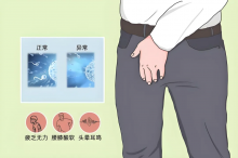 男人为什么精液少？应该如何养精呢？