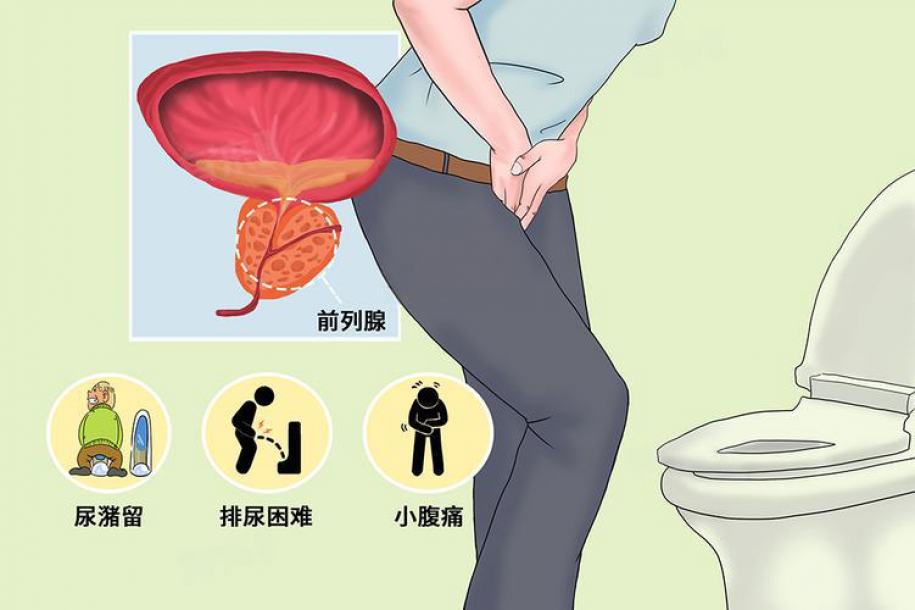 前列腺增生的 “天敌” 找到了!常做这 4 件事，轻松改善超简单