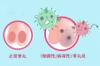 睾丸炎是怎么回事？可能与这4种因素有关，看看自己中招了吗？