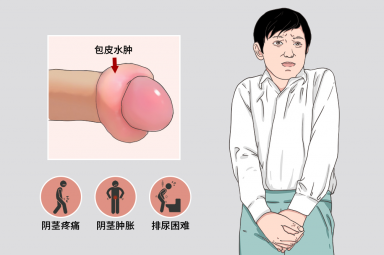 为什么会出现包皮水肿？主要是这3个原因在作怪！