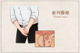 前列腺癌不容易发现？出现这些症状要注意了