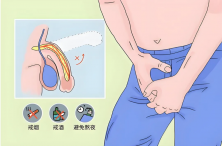 男人性功能障碍不可忽视的4大诱因，一定要防范！
