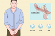 阴茎疼痛是怎么回事？快看看是不是这6个原因！