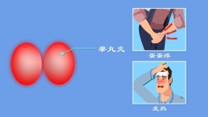 手触摸睾丸有点轻微疼痛是什么原因？