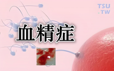 男人血精是怎么回事？可能是这几种疾病导致！