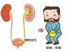 尿路结石总是容易复发？可能与这4大坏习惯有关！