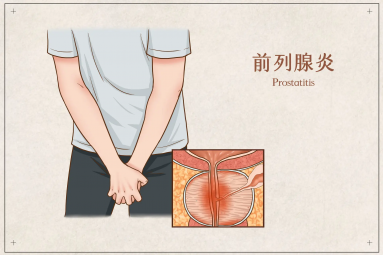 关于前列腺炎的诊疗，临床上的新药开发及试验进展！