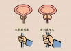 前列腺增生无需治疗？打破5个错误认知！