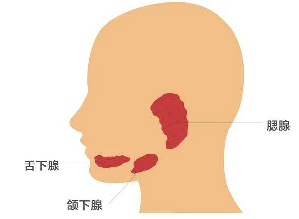 腮腺肿大