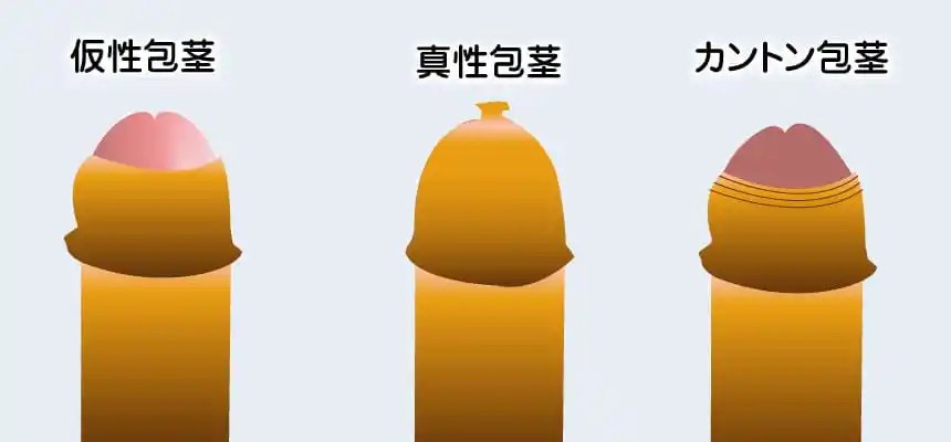 真假