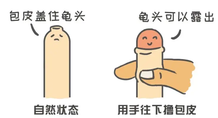 清洗龟头
