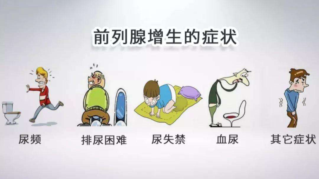 前列腺增生的症状