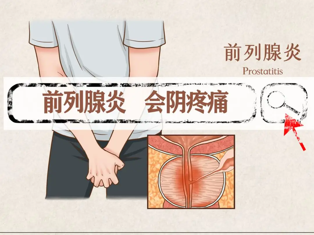前列腺炎1234