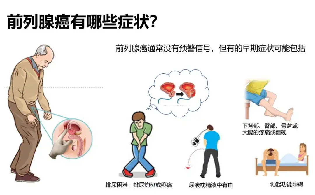 前列腺癌症状