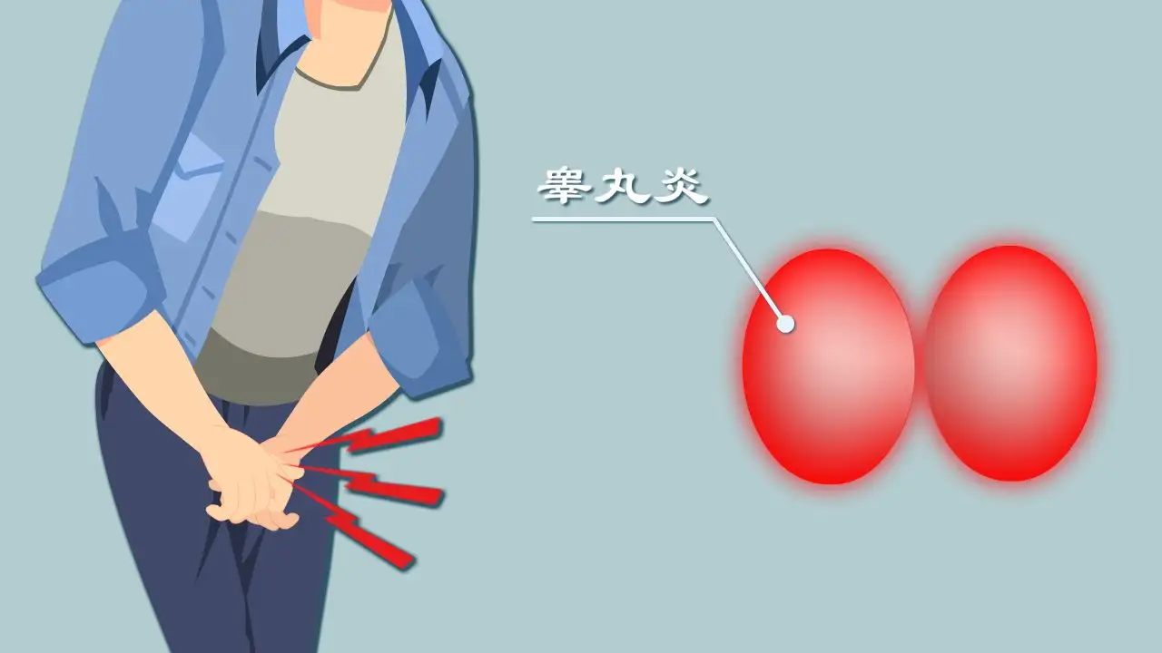 睾丸炎2