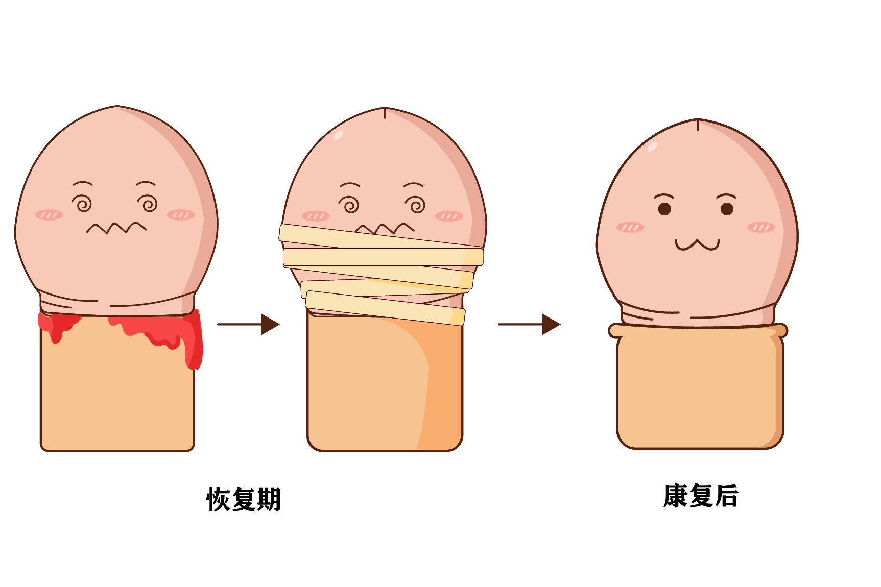 包皮术后