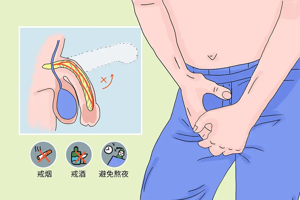 阳痿早泄2