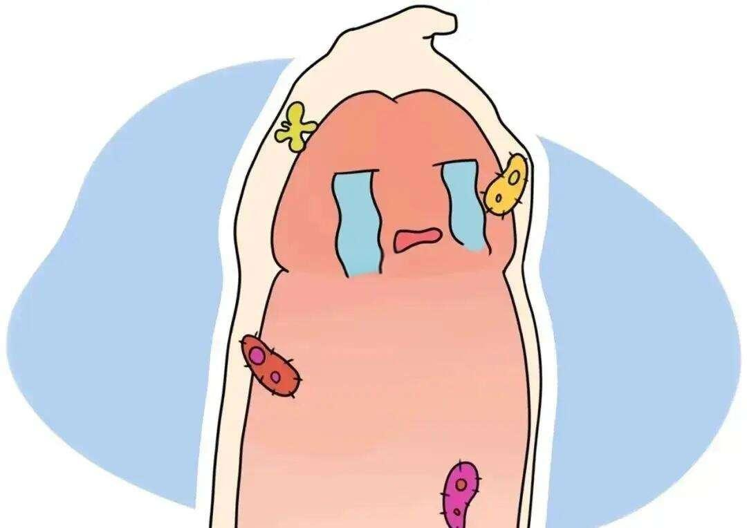 萎缩性包茎