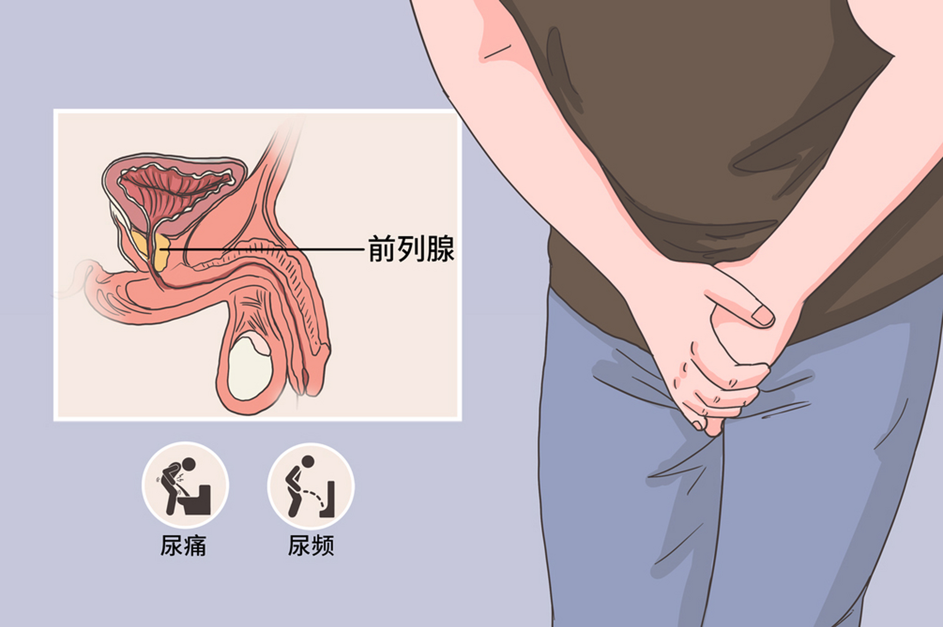 前列腺炎789