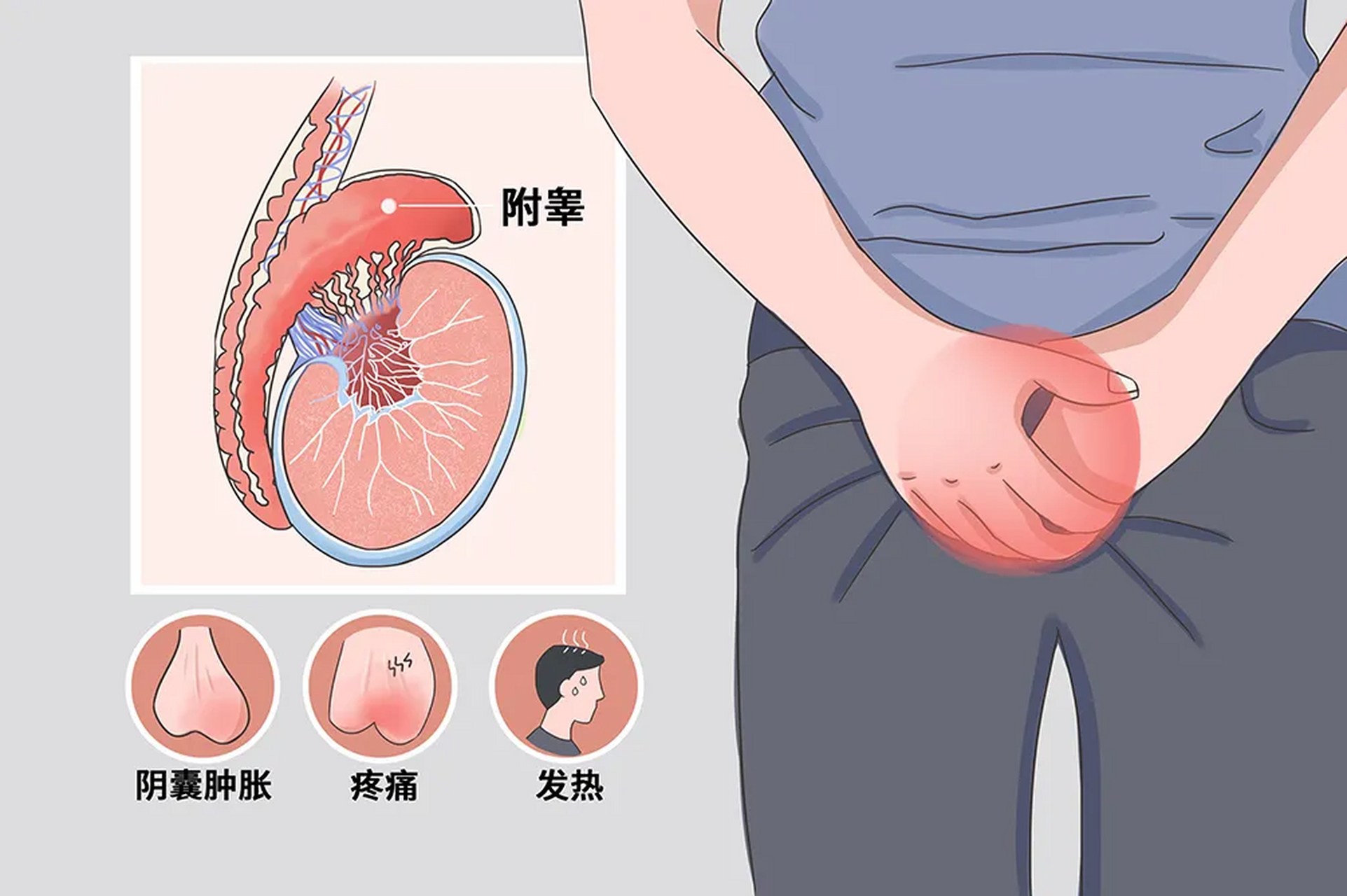 生殖感染