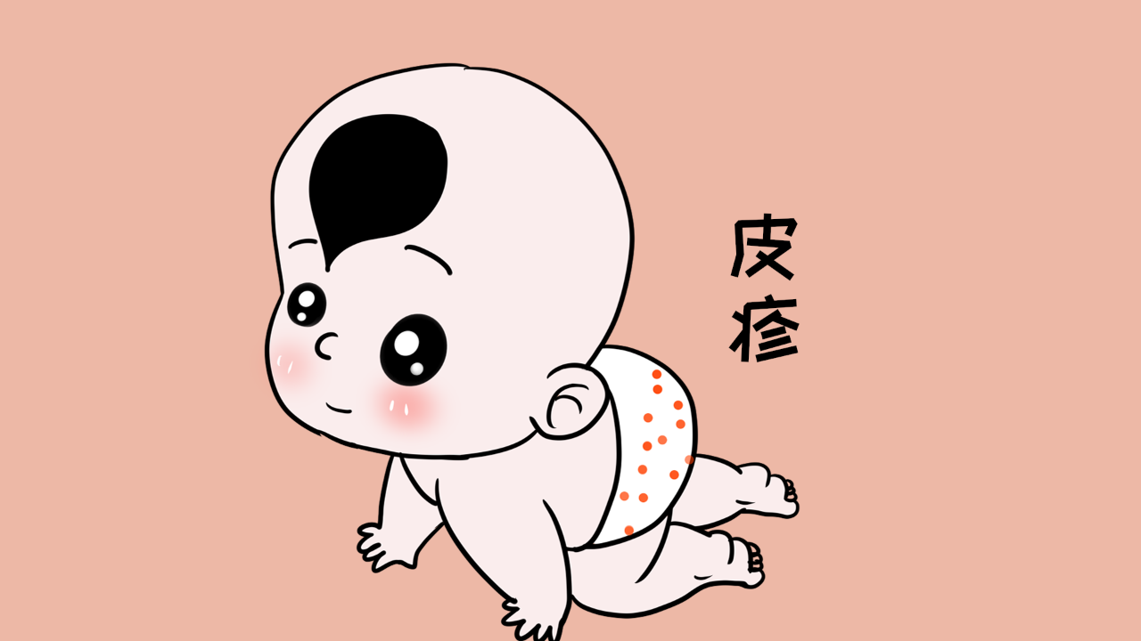 皮疹