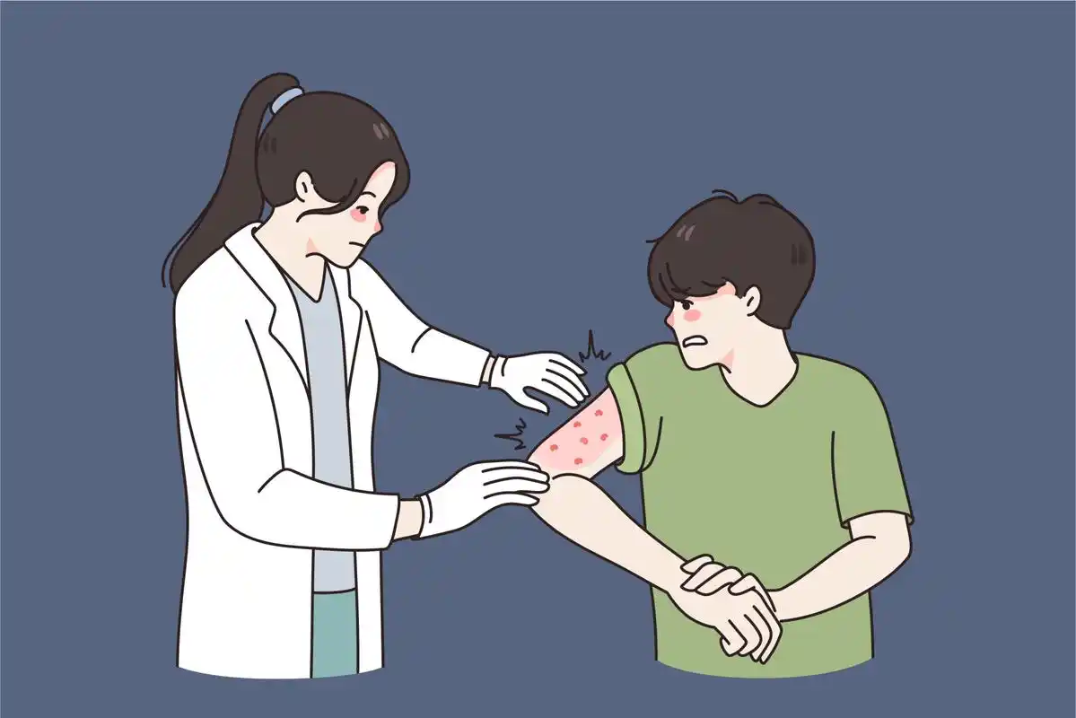 接触性皮炎