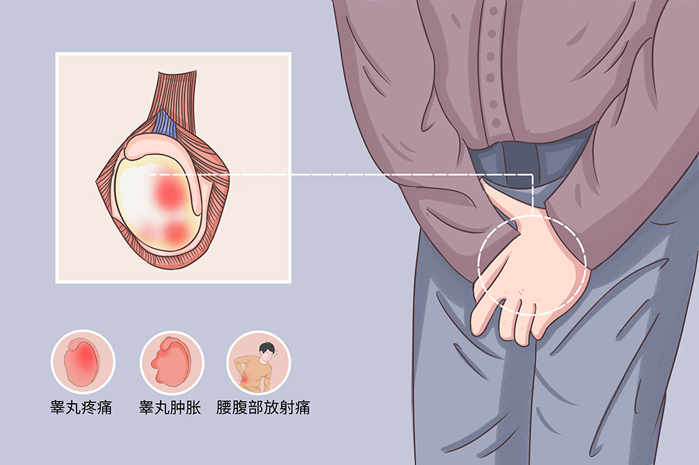 睾丸炎99