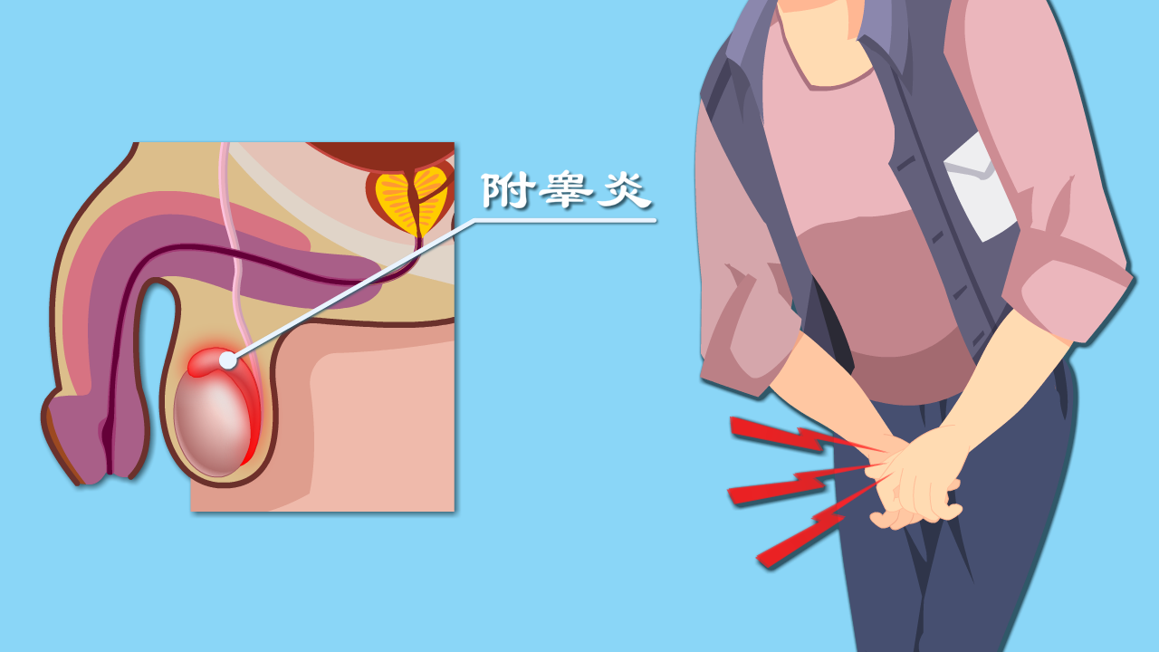 附睾炎2
