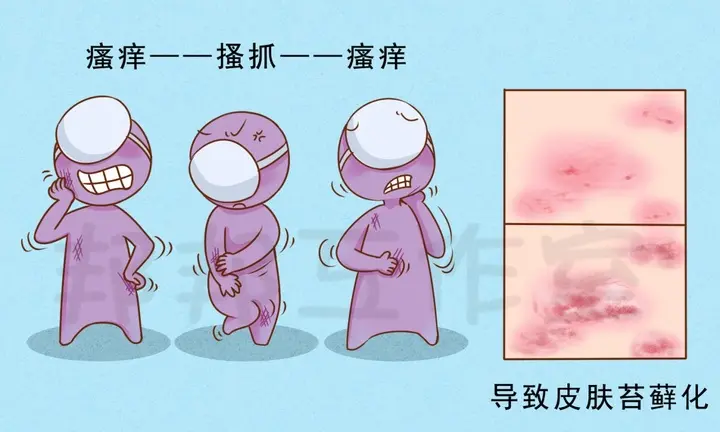 阴囊部位的神经性皮炎
