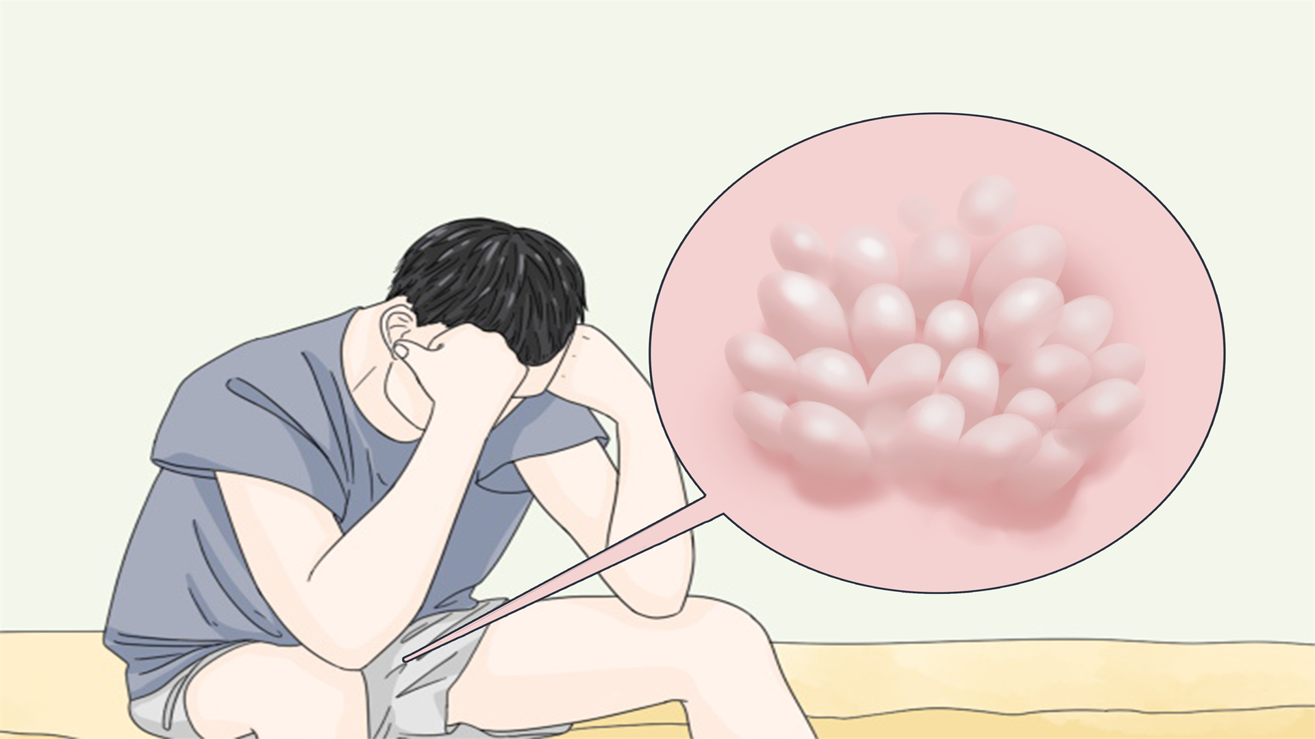 尖锐湿疣