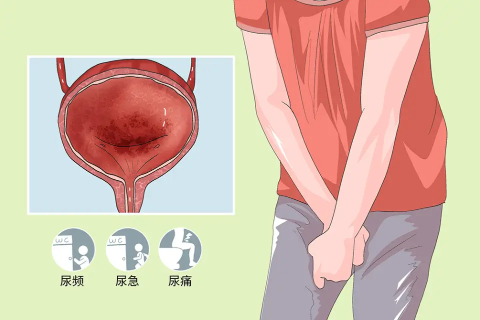 尿道受到了损伤