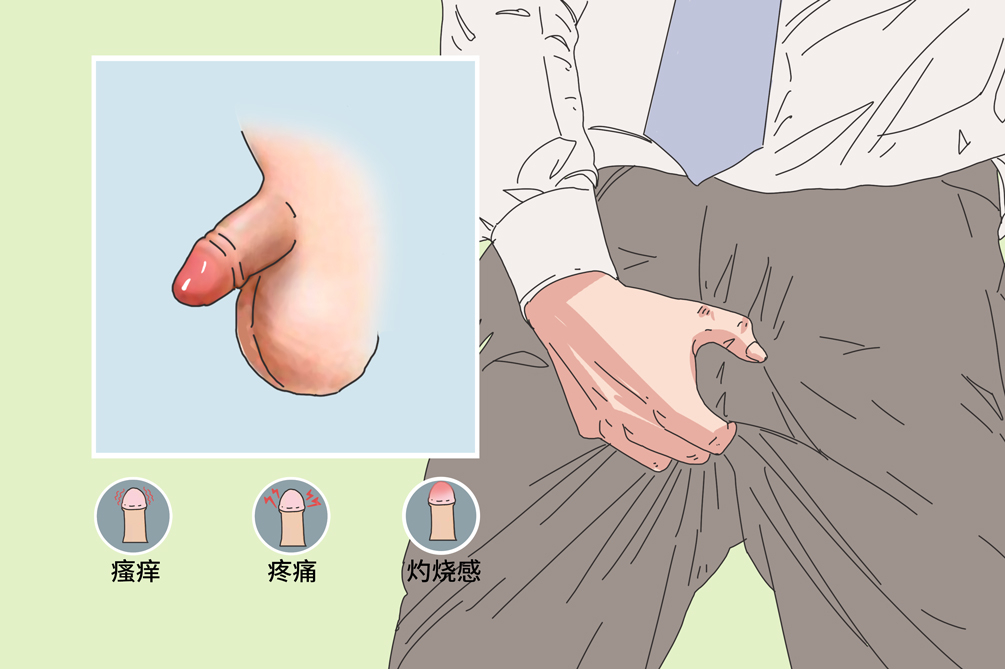 龟头感染