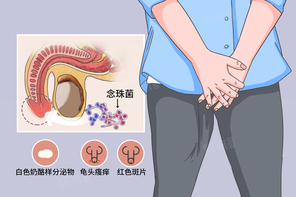 红斑