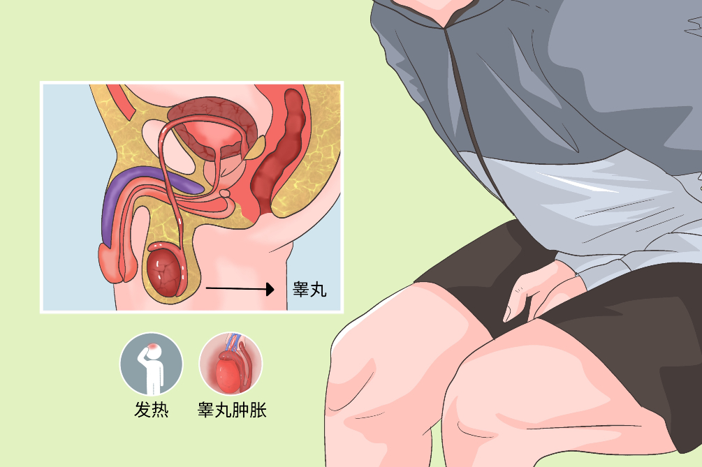 睾丸疼1