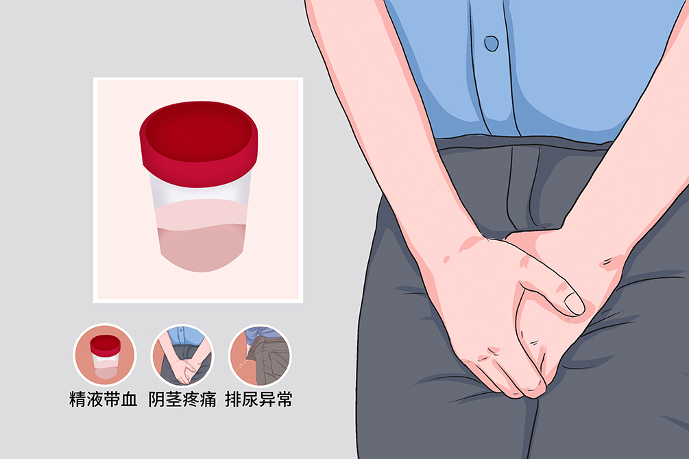 出血性疾病