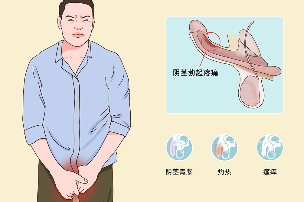 阴茎疼痛