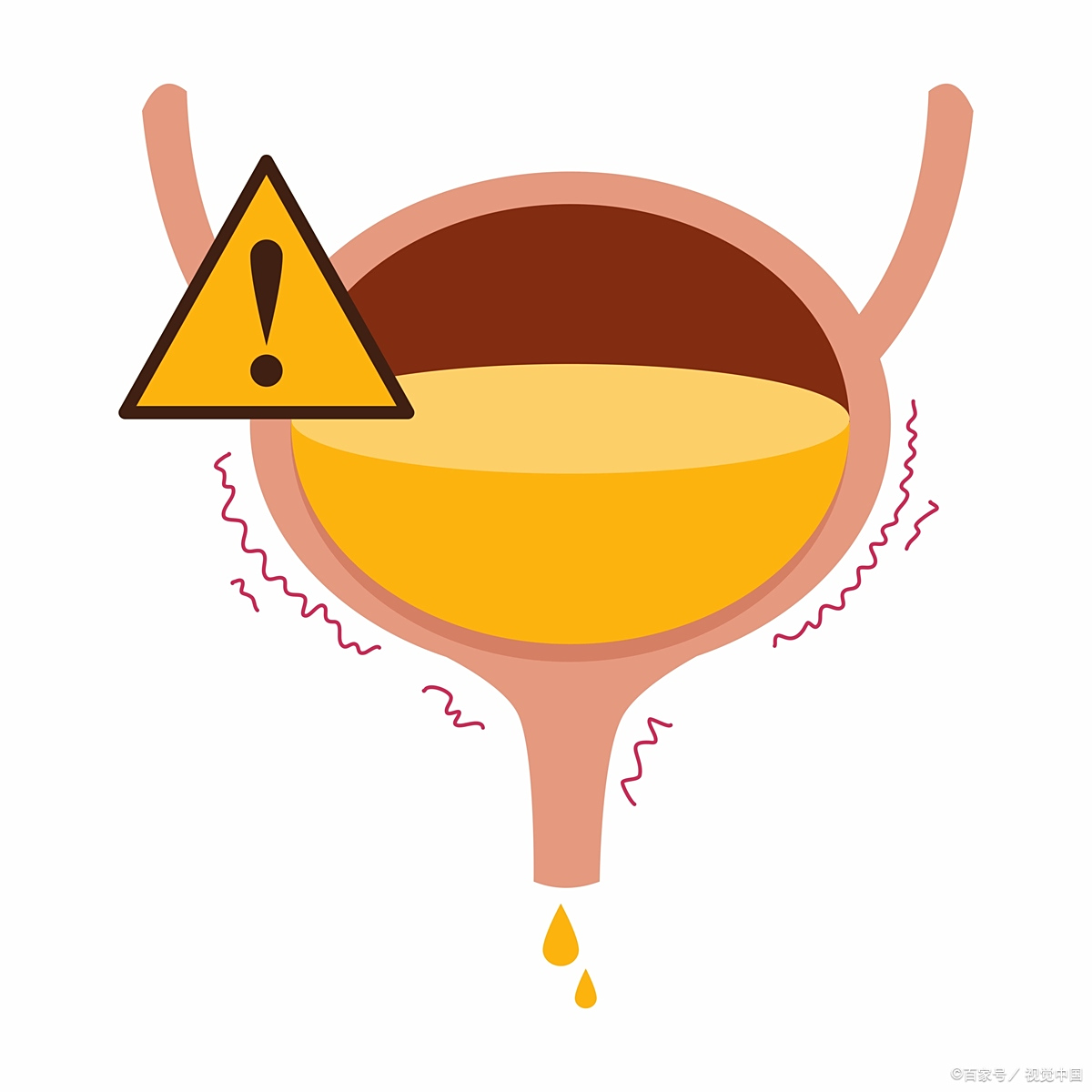 尿液比较混浊 尿液比较混浊