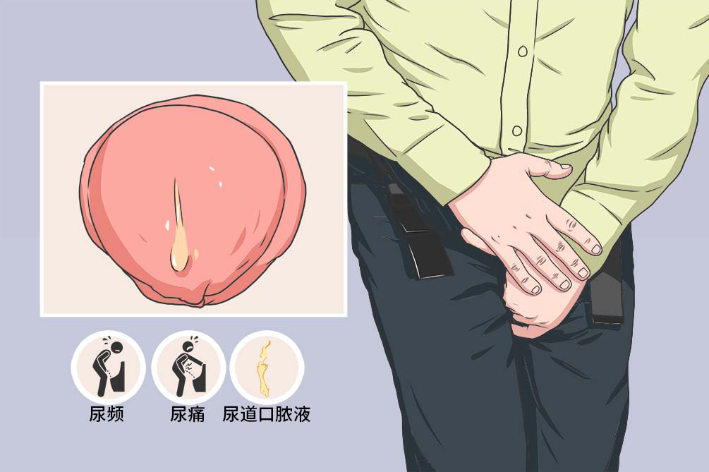 性传播感染 性传播感染